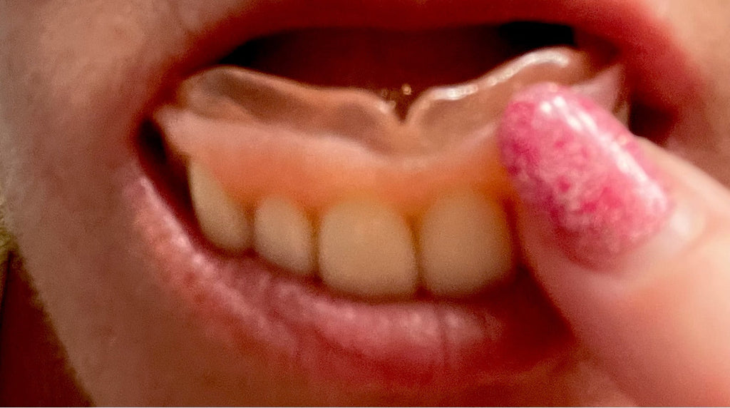 What to Expect with Dentures Guide #DentureLiving