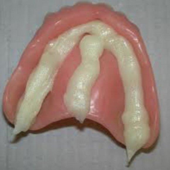Remove Denture Adhesive With These Easy Steps