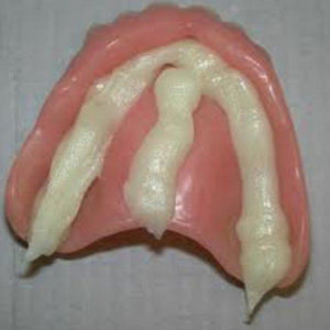Remove Denture Adhesive With These Easy Steps